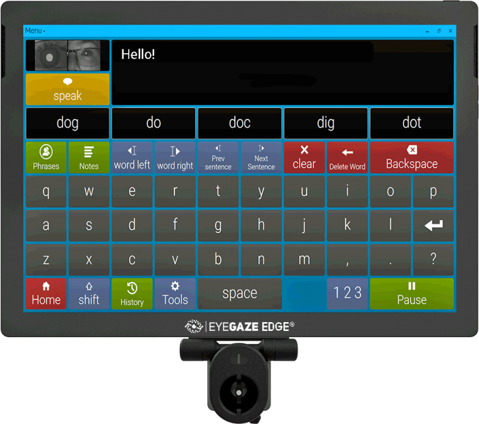 Eyegaze Edge AAC Communication Device - 1
